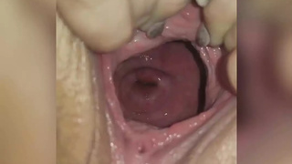 Meaty open cunt and cervix show